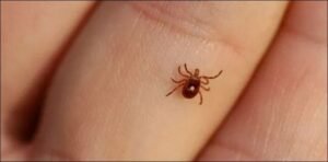 Patient from Quetta tested positive with Congo virus